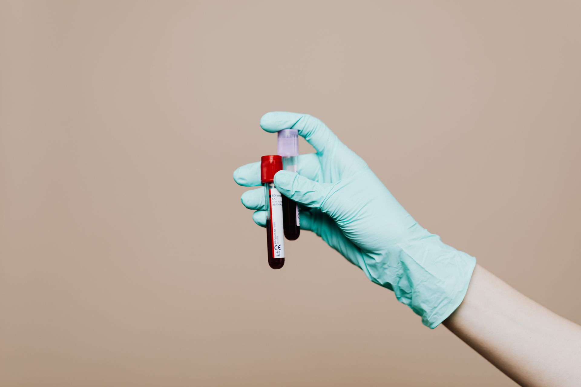 Urologist reviewing PSA test report with patient